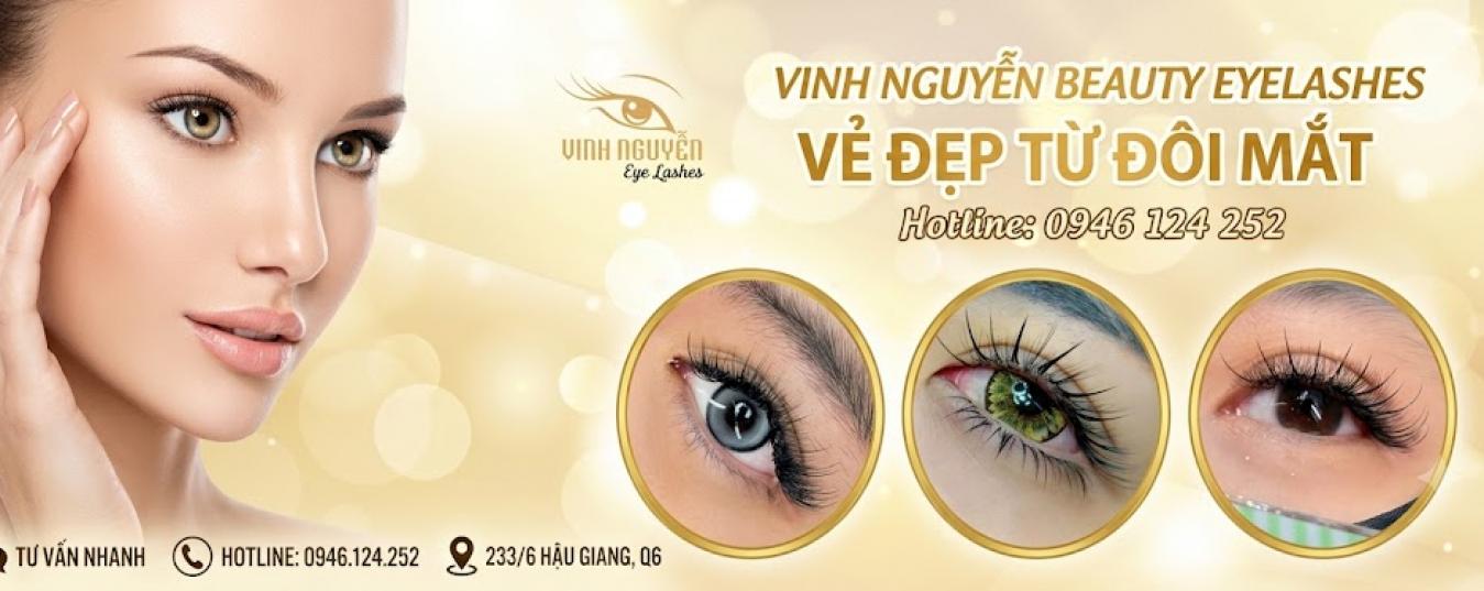 Nối mi Vinh nguyễn